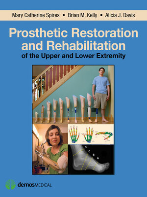 cover image of Prosthetic Restoration and Rehabilitation of the Upper and Lower Extremity